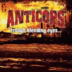 Anticops : Through Bleeding Eyes ... While Everybody's Dying